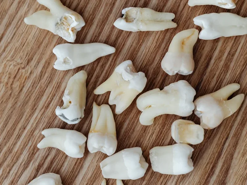 Extracted teeth on a wooden surface